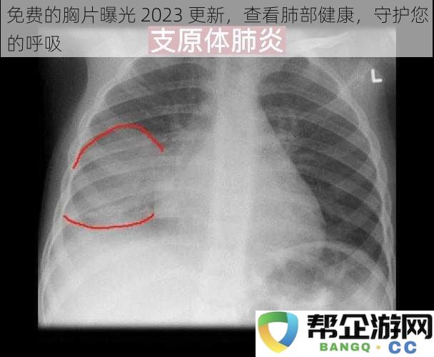 2023年度免费胸部X光检查，关注肺部健康，保护您的呼吸系统